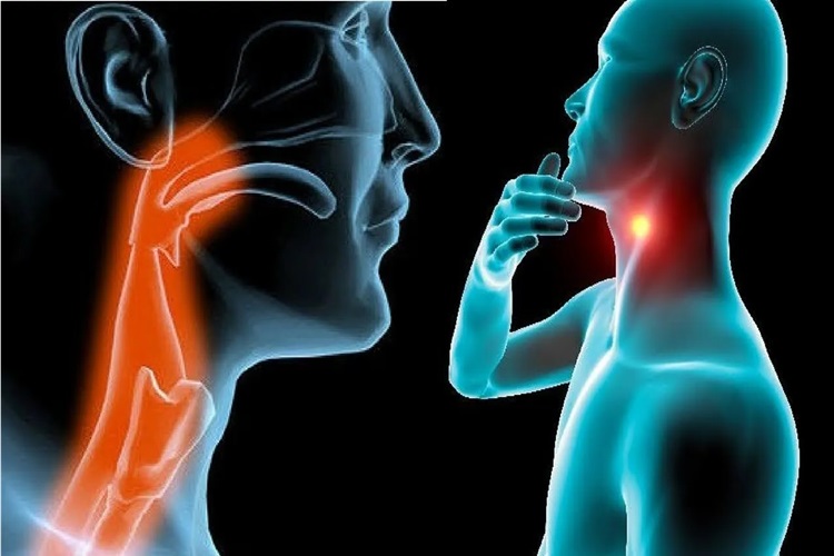 Dicloflam Baş Ağrısına İyi Gelir Mi?