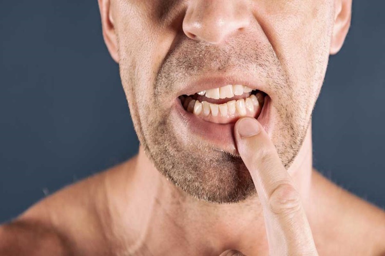 Diş Apsesi İçin Antibiyotik Kaç Mg Alınmalıdır?