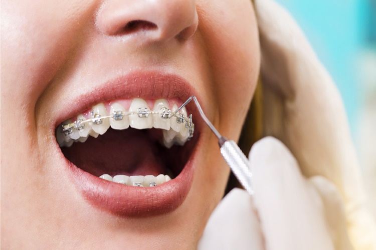 Diş Kliniğinde Uyulması Gereken Kurallar Nelerdir?