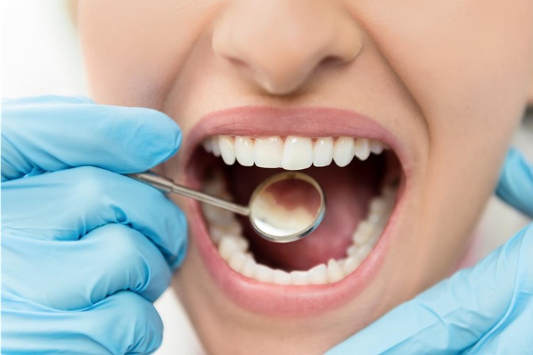 Dişinol Kaç Dakika Bekletilir?