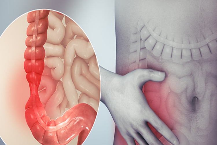 Dışkılama Hissi Neden Olur? Güncel Oku