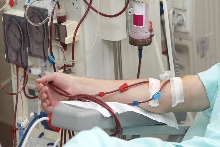 Diyaliz Hastası Yüzde Kaç Rapor Alır?