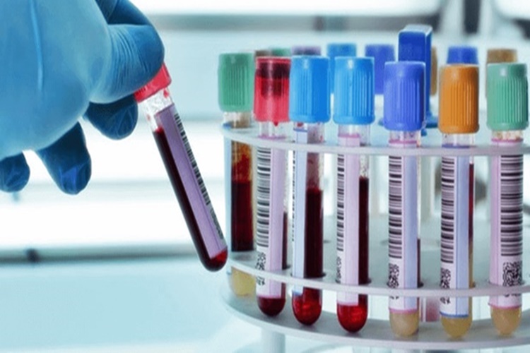 Domuz Gribi Testi Nasıl Yapılır?