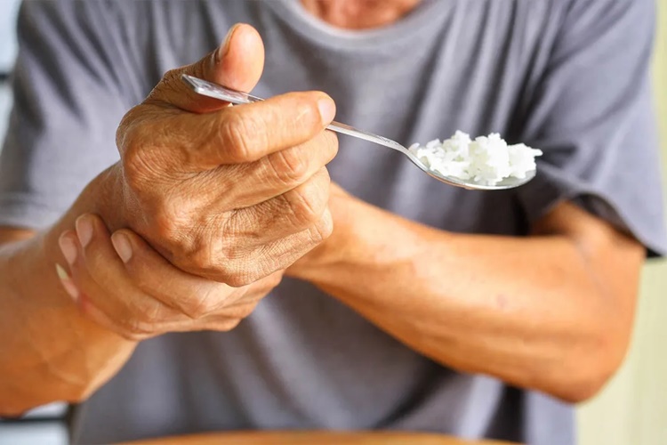 Dopamin Ve Parkinson Hastalığı Arasındaki İlişki Nedir?