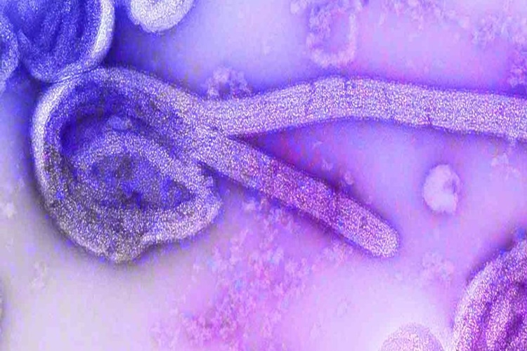 Ebola Hastalığının Tedavisi Var Mı?