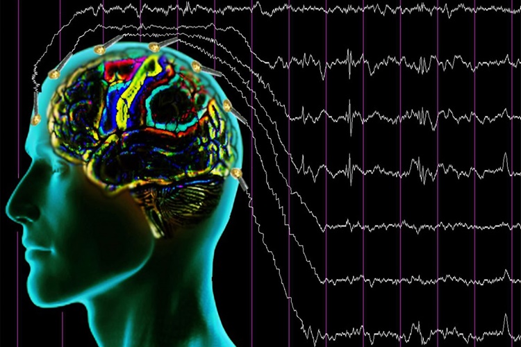 Eeg Nin Bozuk Olduğu Nasıl Anlaşılır?