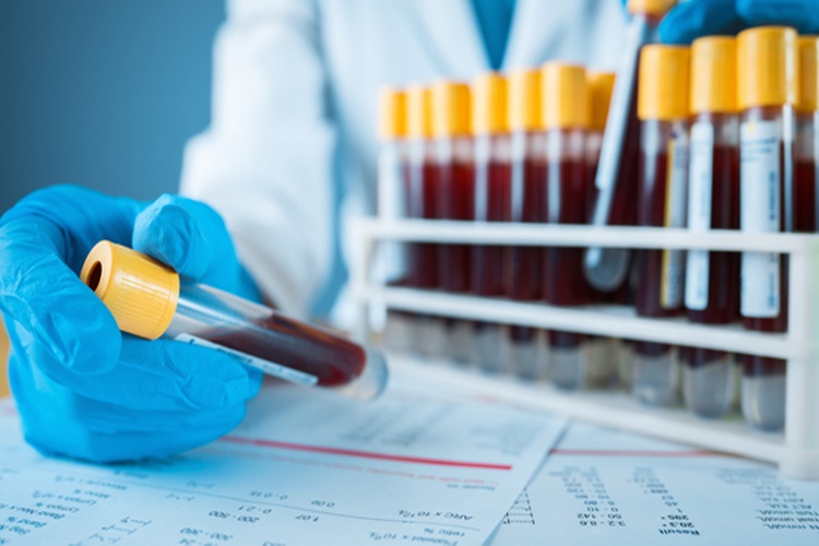 Egfr Testi Neden Yapılır?