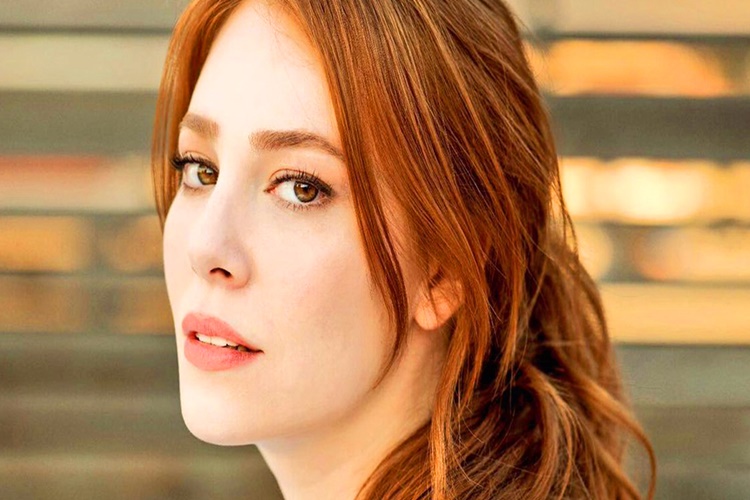 Elçin Sangu Burnu Estetik Mi? Güncel Oku