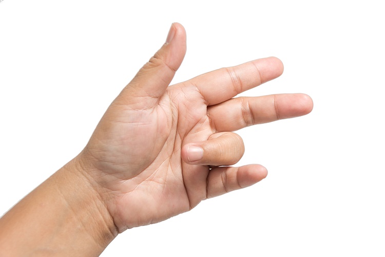 Elde Sinir Sıkışması Stresten Olur Mu?