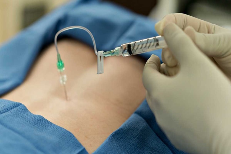 Epidural Doğumda Ağrı Hissedilir Mi?