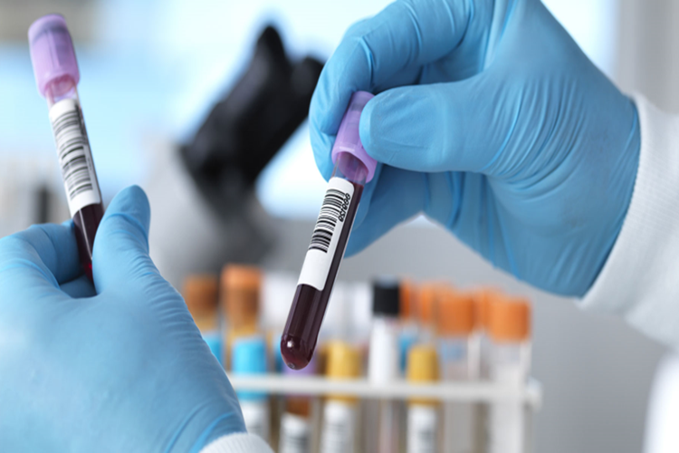Eritropoetin Hormonu Nedir?