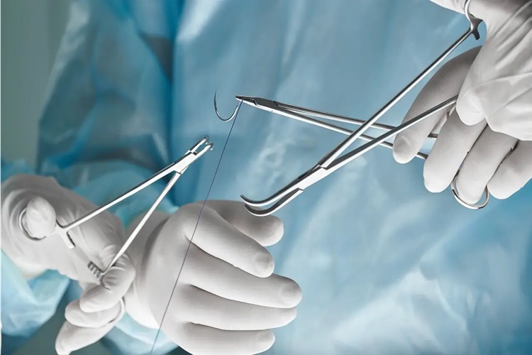 Eriyen Dikiş Ne Zaman Erir? Güncel Oku