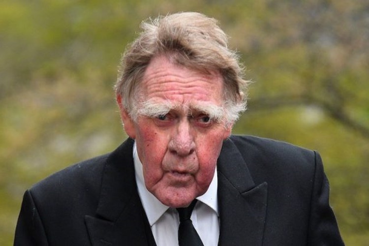 Erkeklerde Kaş Uzaması Nasıl Durdurulur?