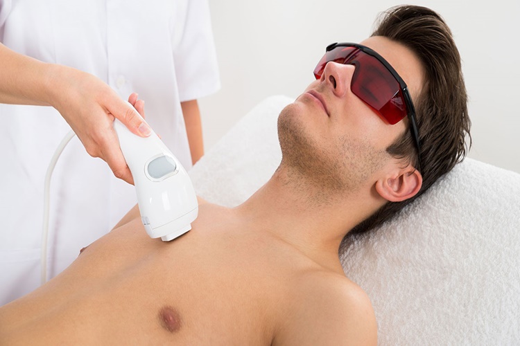 Erkeklerde Lazer Epilasyon Nasıl Yapılır?