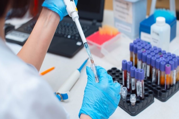 Evlenmeden Önce Hiv Testi Yapılır Mı?