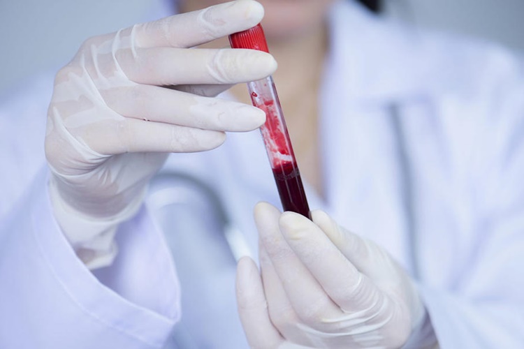 Evlenmeden Önce Kan Uyuşmazlığı Testi Nasıl Yapılır?