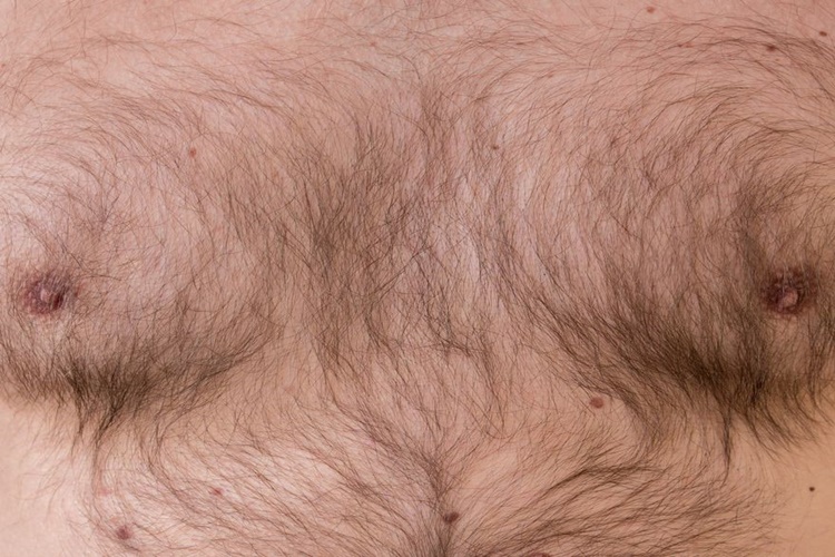 Excipial Lipo Tüylenme Yapar Mı?