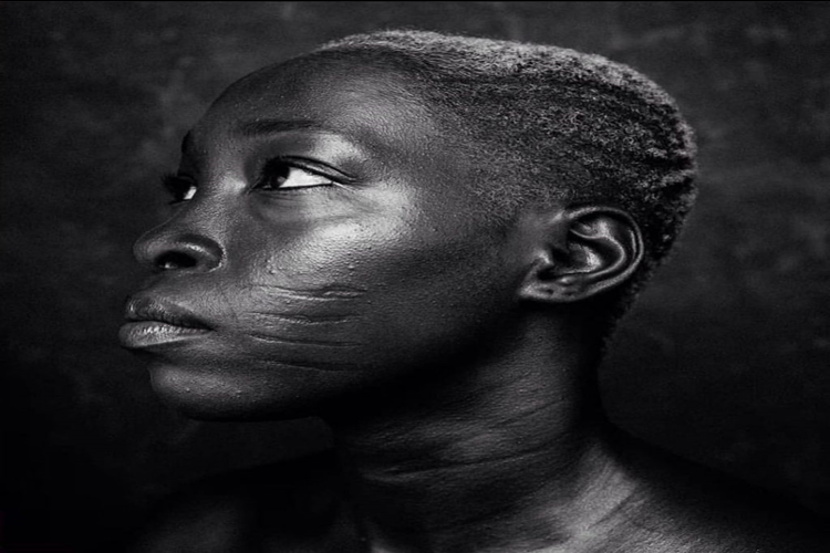 Sürtme izi nasıl geçer