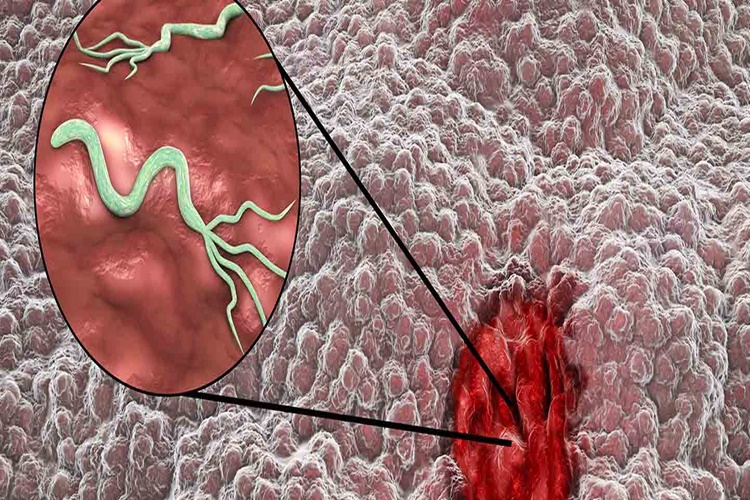 Famodin Mide Ağrısına İyi Gelir Mi?