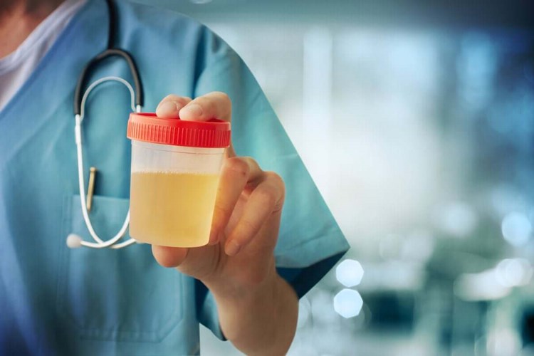 Fazla C Vitamini İdrar Rengini Değiştirir Mi?