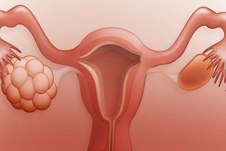 Femara Kaç Gün Kullanılır?