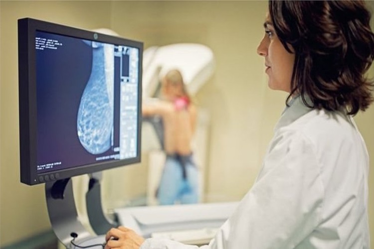 Femara Kilo Aldırır Mı?