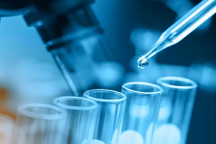 Fenolik Sararma Testi Nasıl Yapılır?