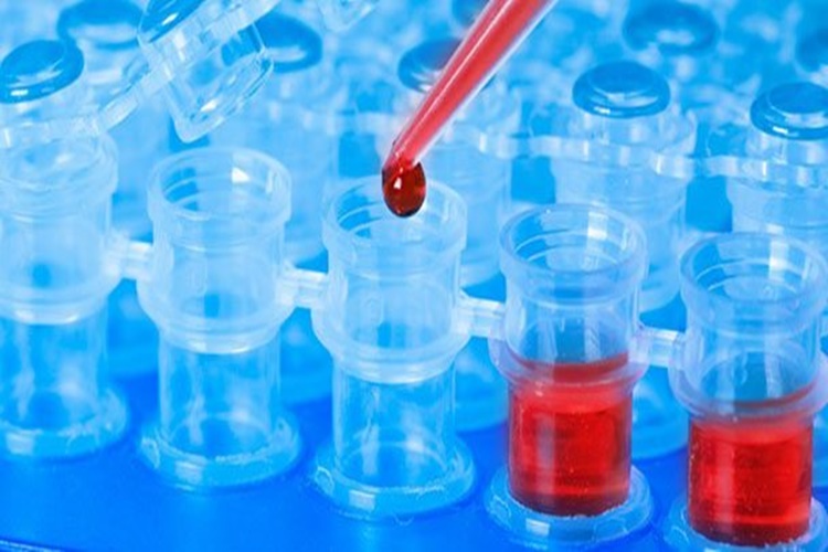 Ferritin Kaç Olursa Tehlikelidir?