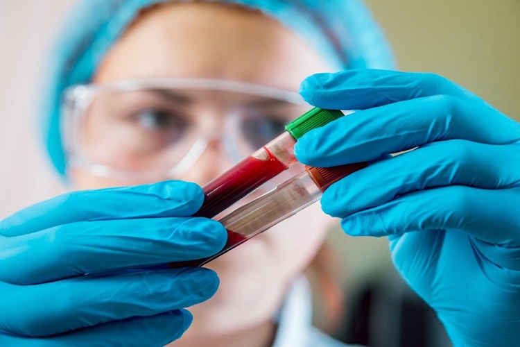 Ferritin Neyi Gösterir?