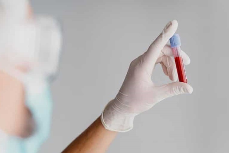 Ferritin Yüksekliği Kaç Olursa Tehlikelidir?