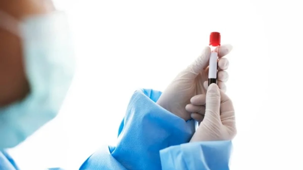Fetal Dna Testi Aç Karnına Mı Yapılır?