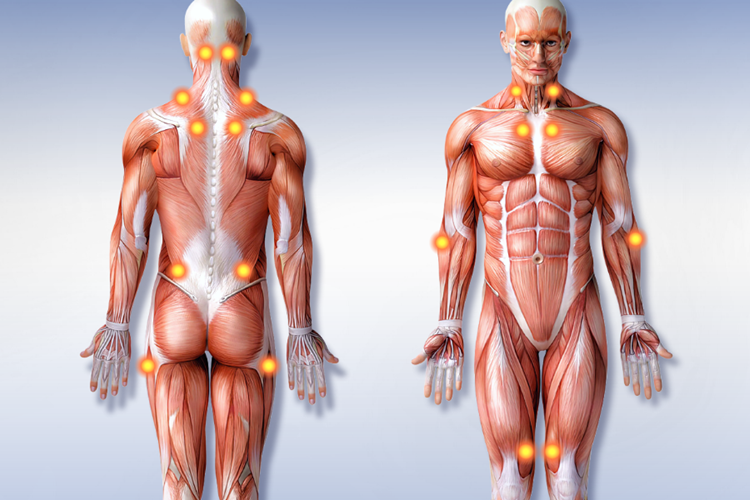 Fibromiyalji Baş Ağrısı Yapar Mı?