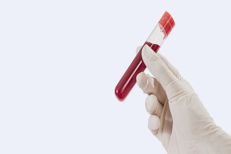 Folik Asit Testi Neden Yapılır?