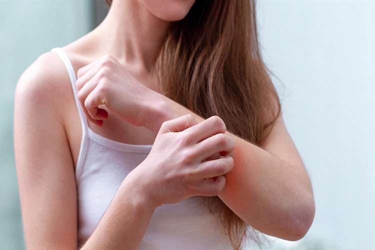 Forziga Kaşıntı Yapar Mı?