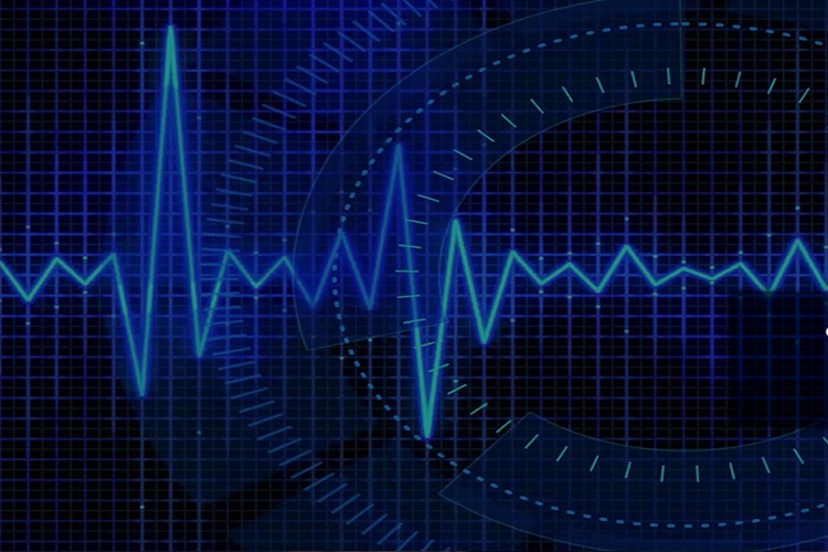 Frekans Nasıl Ölçülür?