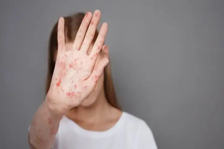 Frengi Hastalığı Nasıl Bulaşır?