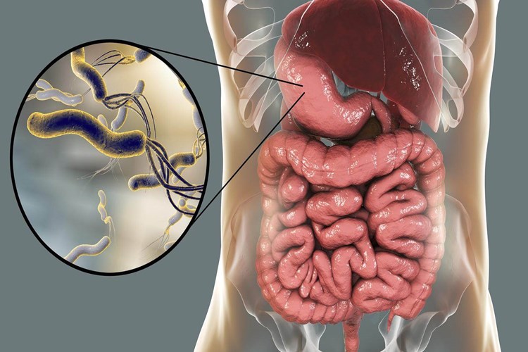 Gastrit Demir Eksikliği Yapar Mı?