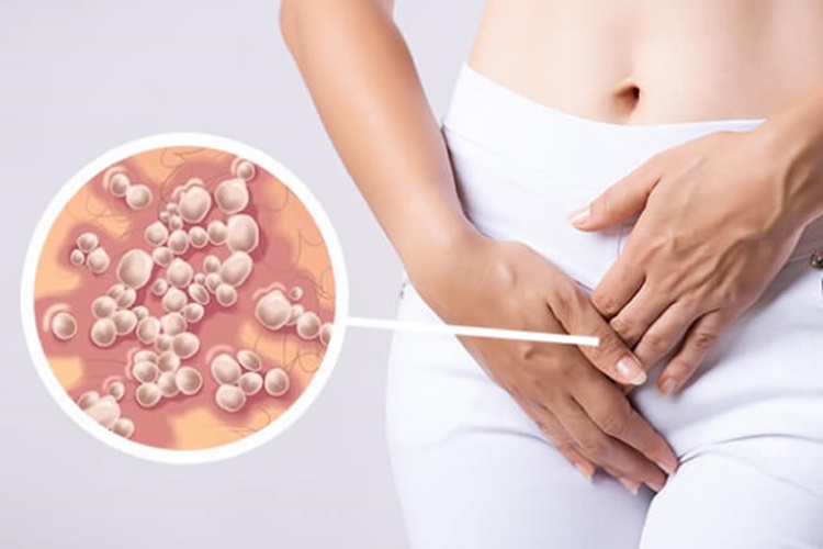 Genital Siğil Zamanla Geçer mi?