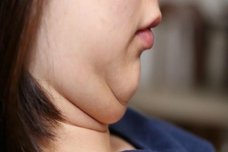 Gıdı İçin Yüz Yogası Nasıl Yapılır?