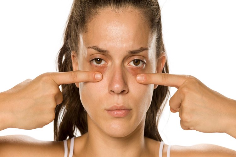 Göz Çevresine Propolis Sürülür Mü?