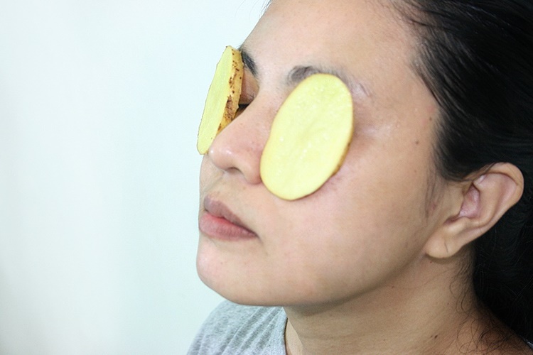  Göz Şişliğine Patates İyi Gelir Mi?