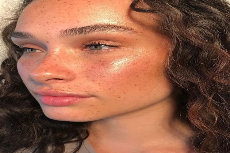 Güneş Lekesine Ne İyi Gelir?