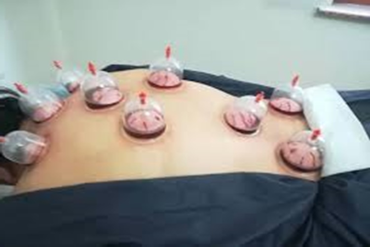 Hacamat Kulak Ağrısına İyi Gelir Mi?