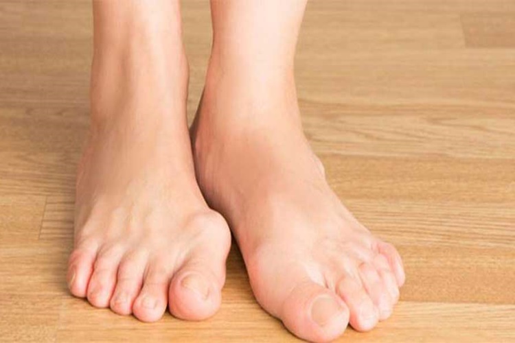 Halluks Valgus Polisliğe Engel Mi?