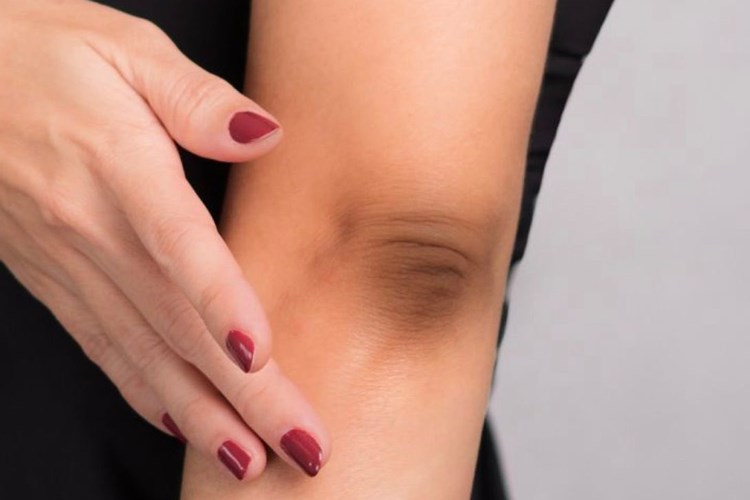 Hametan Krem Kararmalara İyi Gelir Mi?