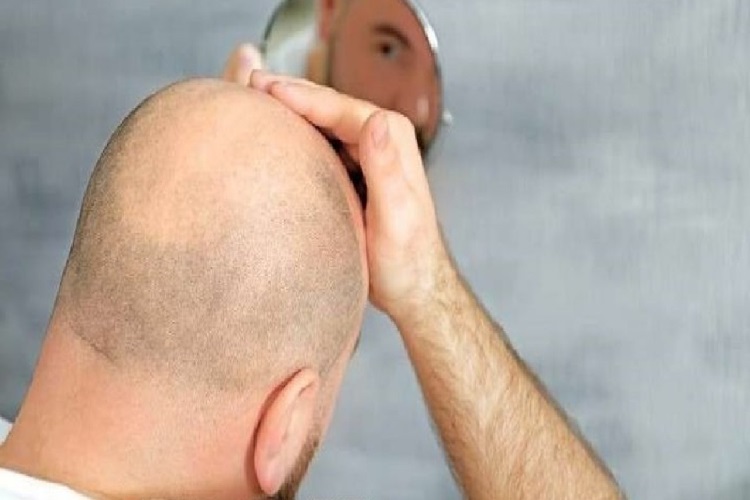 Hangi Besinler Saç Çıkarır?