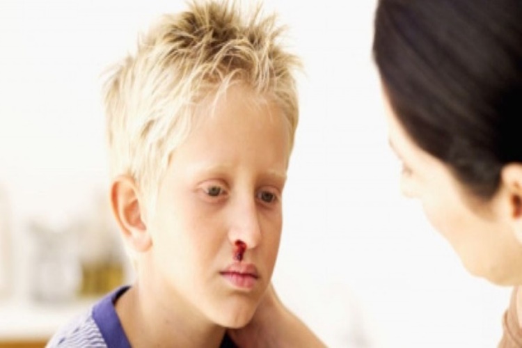 Hemofili Hastalığı Genetik Midir?