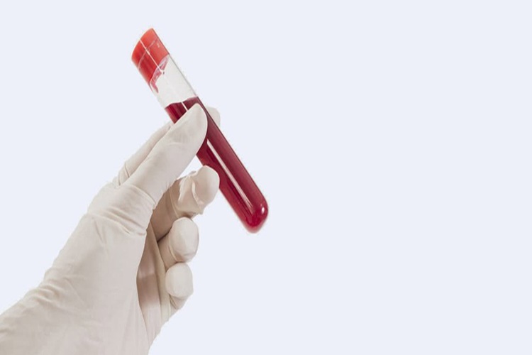  Hemogram Testi Aç Karnına Mı Yapılır?
