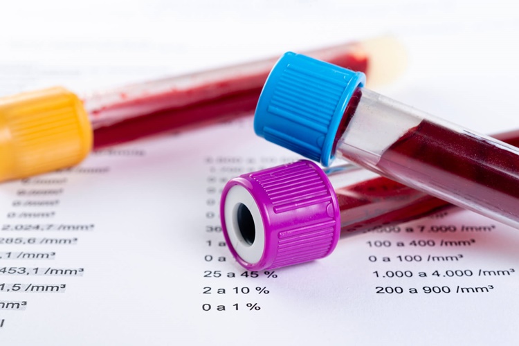 Hemogram Testi Neden Yapılır?
