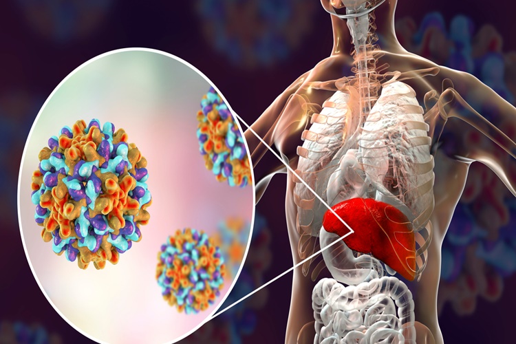 Hepatit A Kronikleşir Mi?